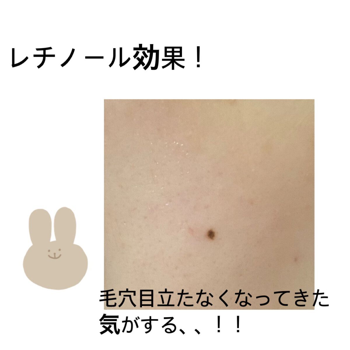 レチノールインテンスリアクティベーションセラム/SOME BY MI/美容液を使ったクチコミ(1枚目)