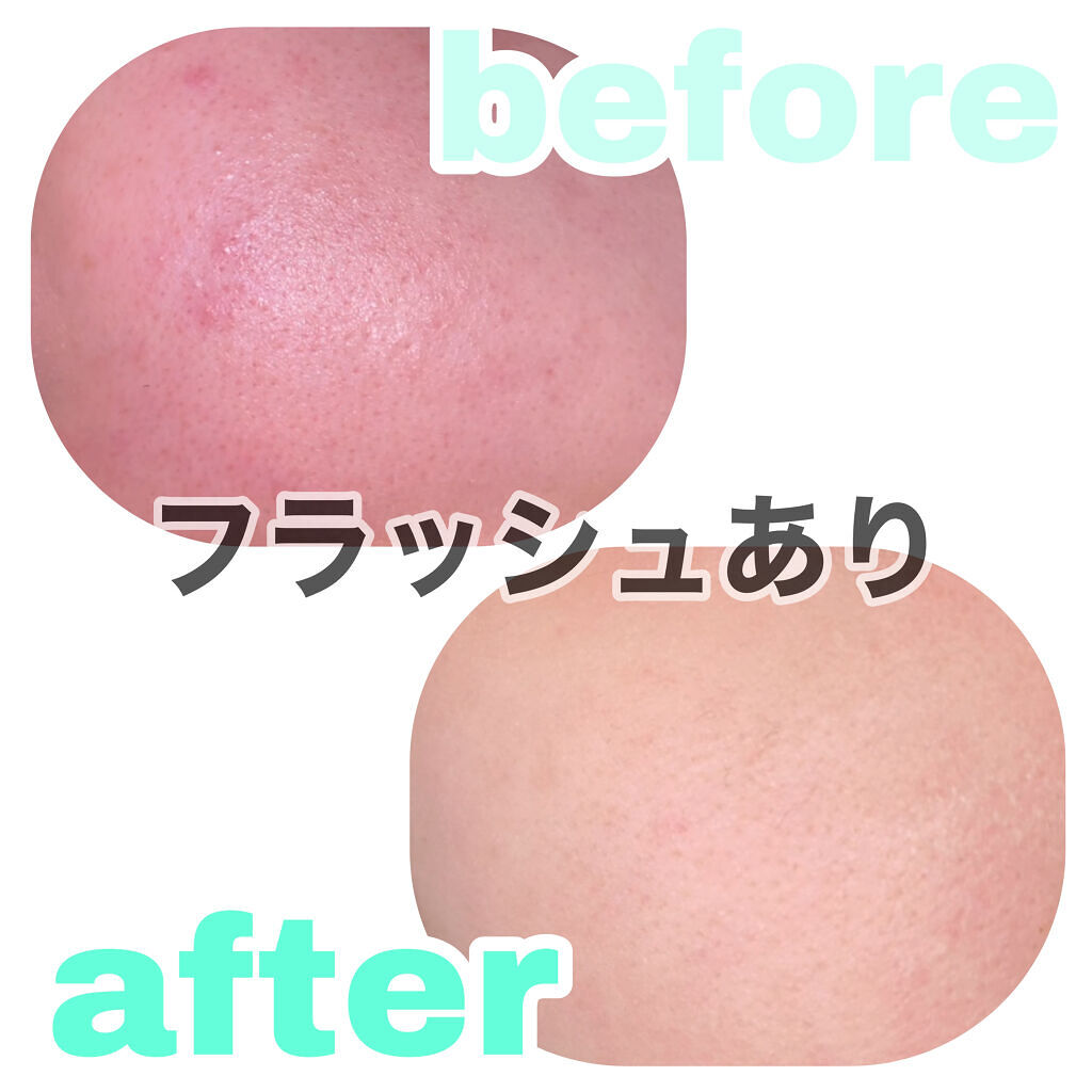 オイルコントロールパウダー＜医薬部外品＞/ファンケル/プレストパウダーを使ったクチコミ（2枚目）