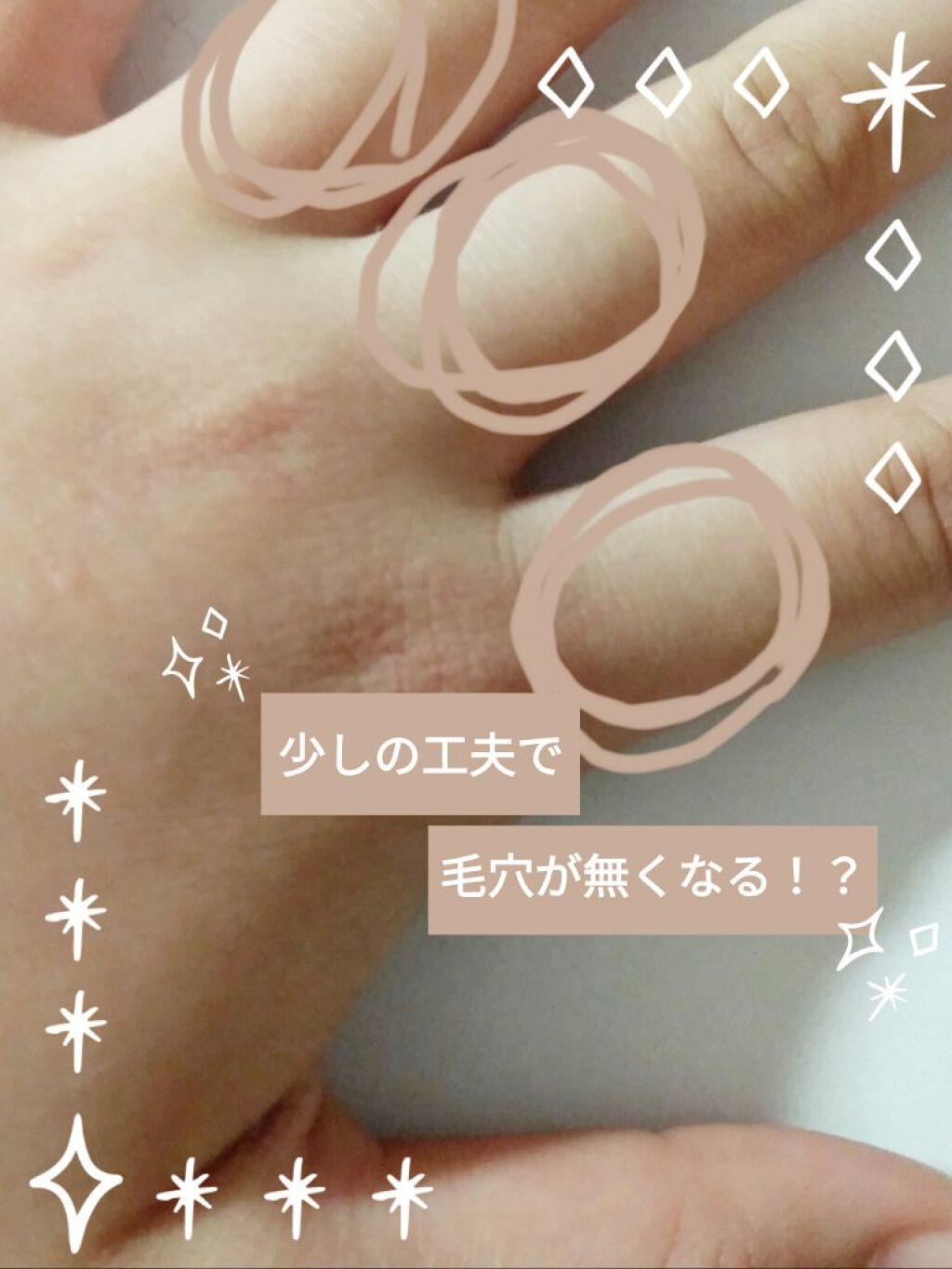 シック Schick Lディスポ 使い捨て 顔そり用 (3本入)×3個/シック/シェーバーを使ったクチコミ（1枚目）