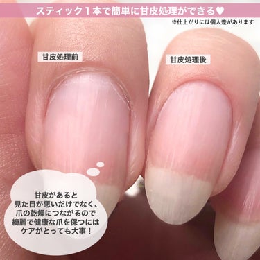 ネイリスト キューティクルケアスティックのクチコミ「美爪育成の基本💅甘皮ケアをセルフで簡単に💕
押す・切る・削るをスティック1本で🪄
⁡
⁡
誰で.....」（2枚目）