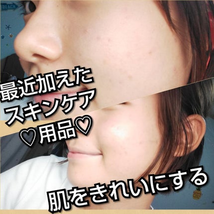 DHC オリーブバージンオイル/DHC/フェイスオイルを使ったクチコミ(1枚目)