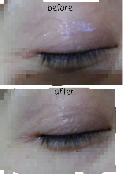 リキッドフィルム 2/ラクオリ/二重まぶた用アイテムを使ったクチコミ(6枚目)