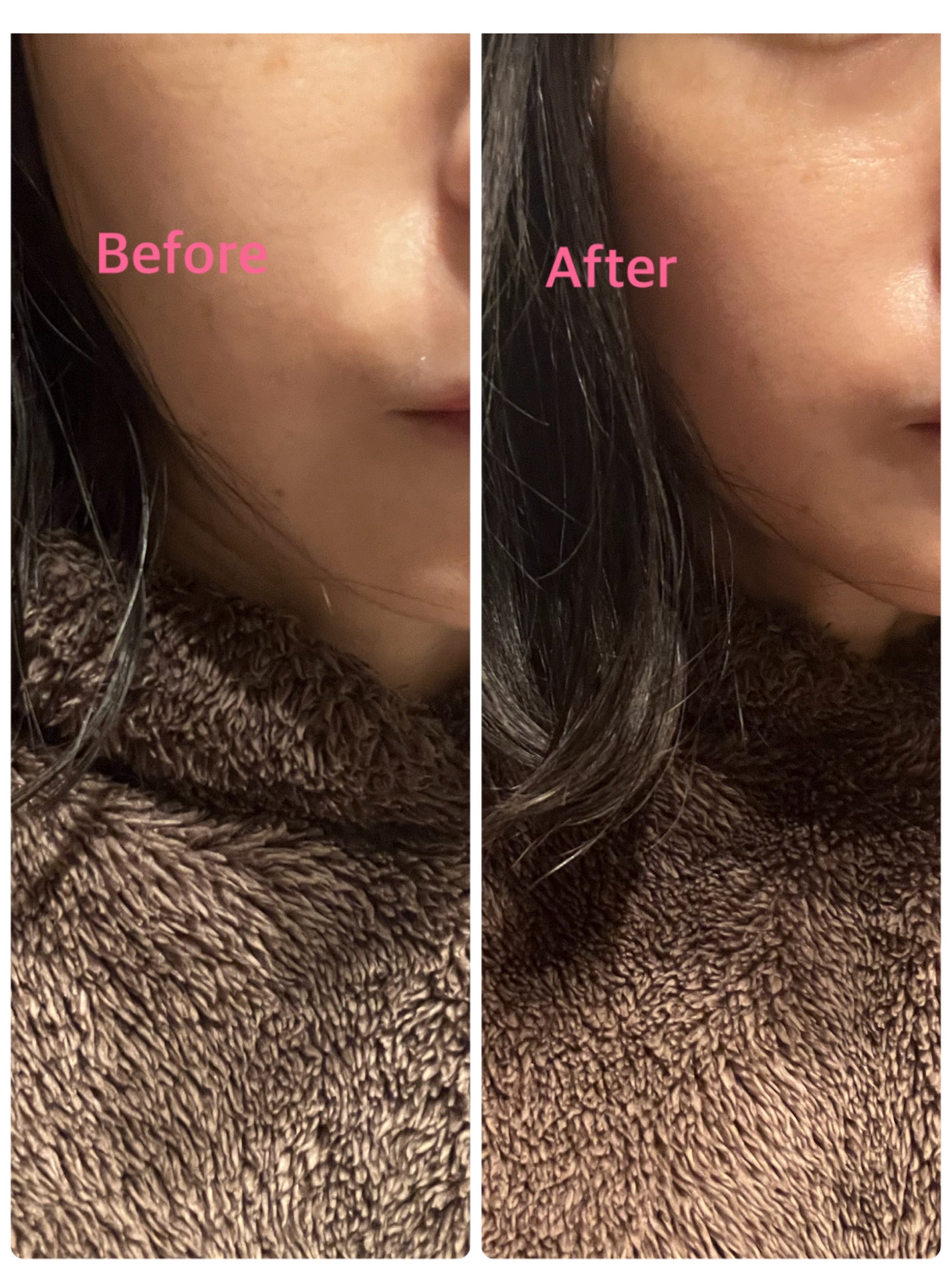 ウルトラグロウバー/b.glen/美容液を使ったクチコミ(3枚目)