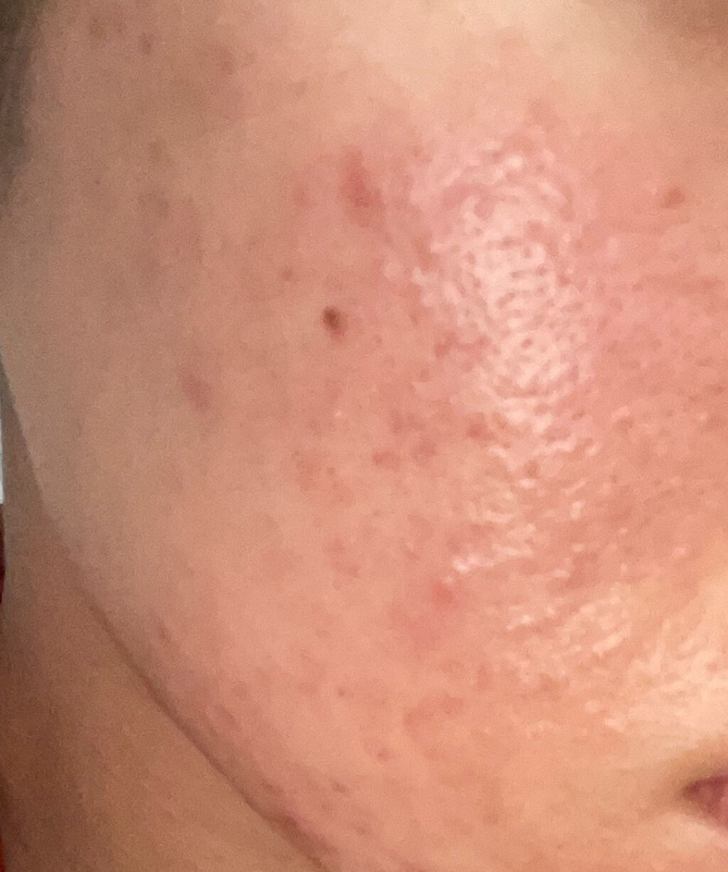 白潤 薬用美白化粧水/肌ラボ/化粧水を使ったクチコミ（1枚目）