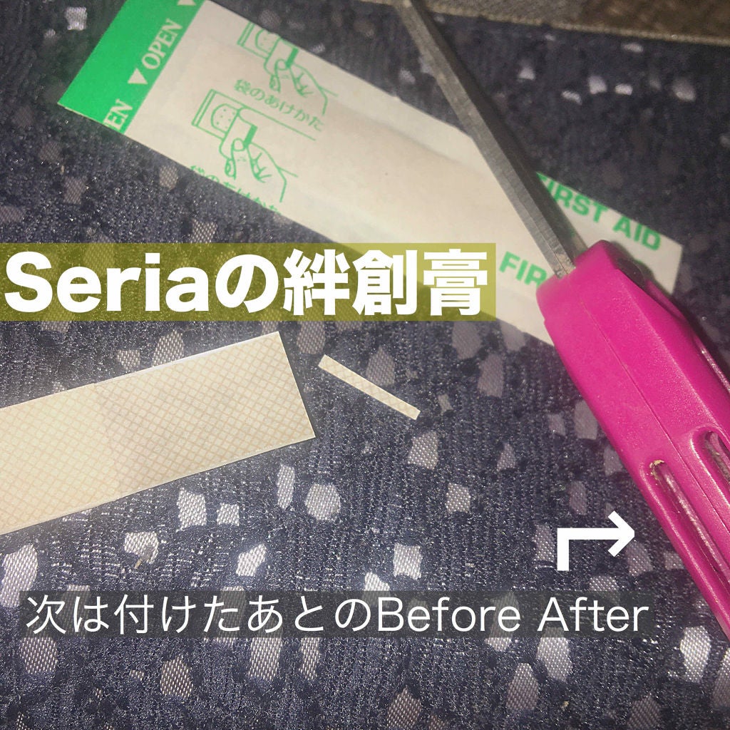 ãœãð on LIPS ãé åºãªæ¿éã²ãšãã ã£ãç§ãããŠããçµåµèã¢ã€ããã®ããæ¹ã§ãâº..ãïŒ2æç®ïŒ