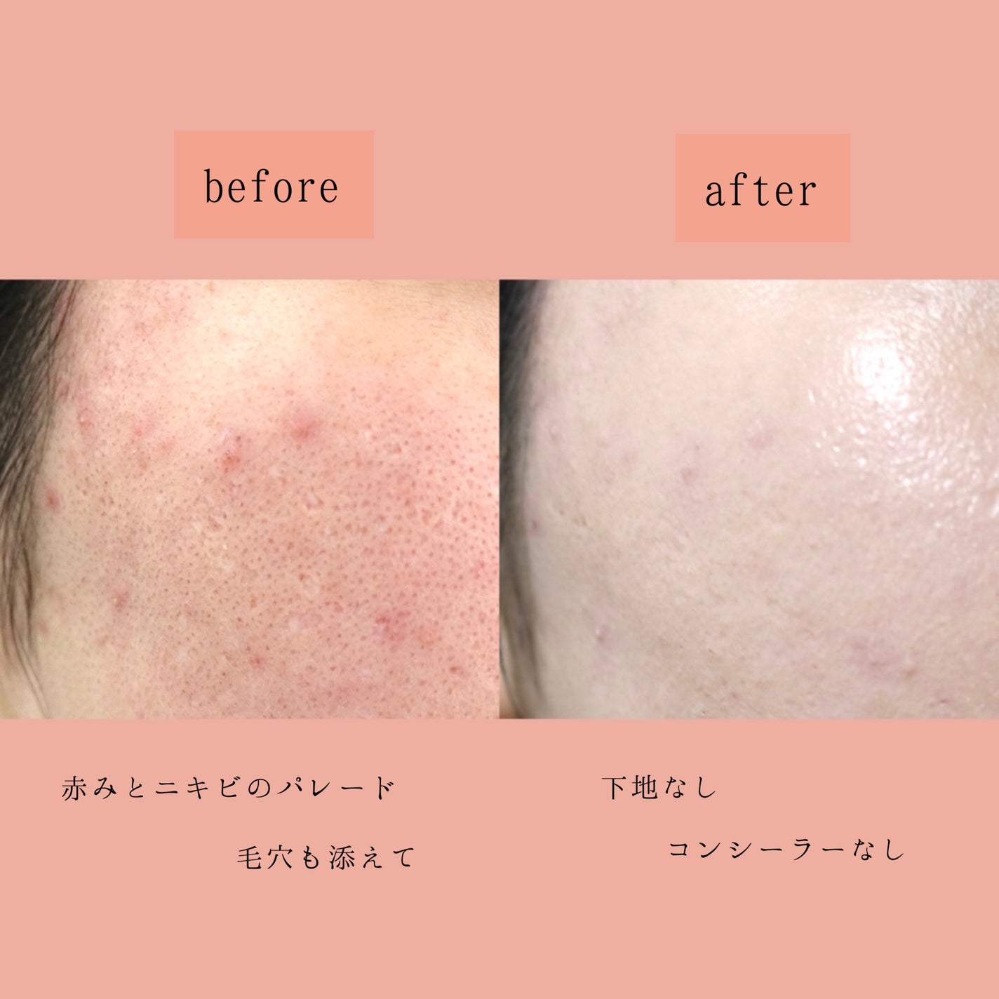 ピンクティーツリーカバーアップグロウクッション/APLIN/クッションファンデーションを使ったクチコミ(4枚目)