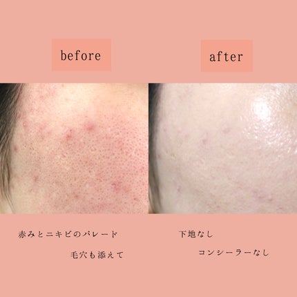 ピンクティーツリーカバーアップグロウクッション/APLIN/クッションファンデーションを使ったクチコミ(4枚目)
