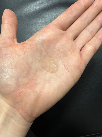 マンデリック インテンシブ 18%セラム/DR.WU/美容液を使ったクチコミ(5枚目)