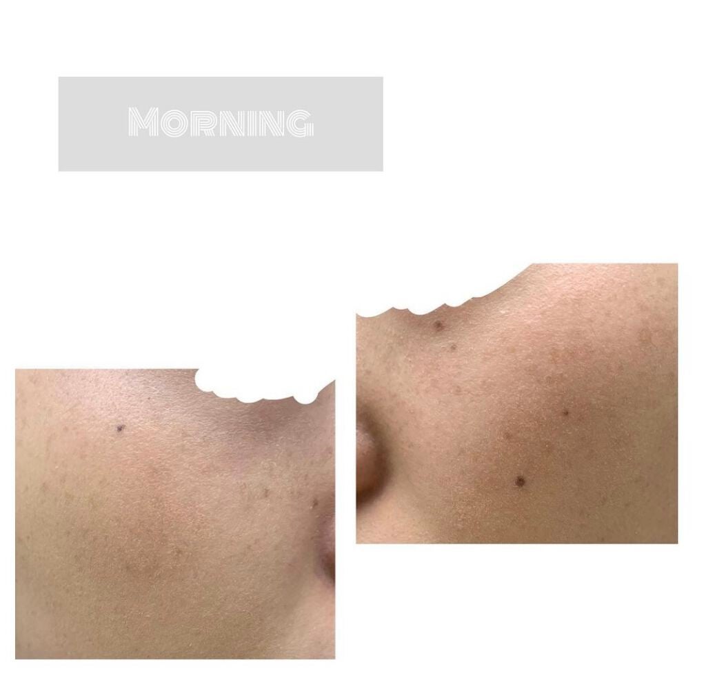 キル カバー ファンウェア クッション エックスピー/CLIO/クッションファンデーションを使ったクチコミ(2枚目)