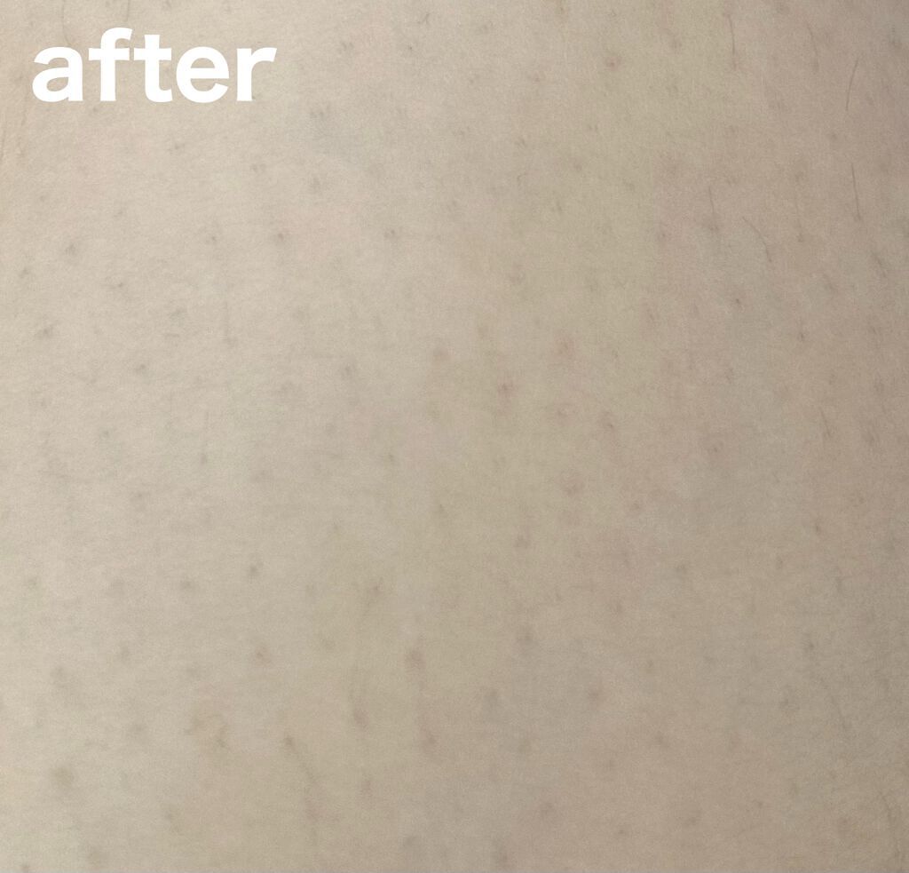 つるすべ除毛パッド/DAISO/ムダ毛ケアを使ったクチコミ(4枚目)