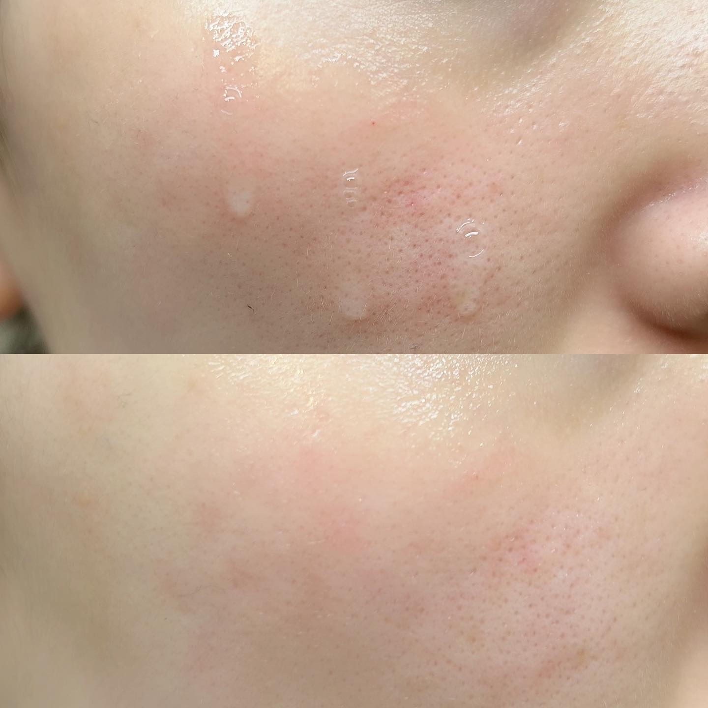 ルミエール ヴァイタルC/FEMMUE/ブースター・導入液を使ったクチコミ（3枚目）