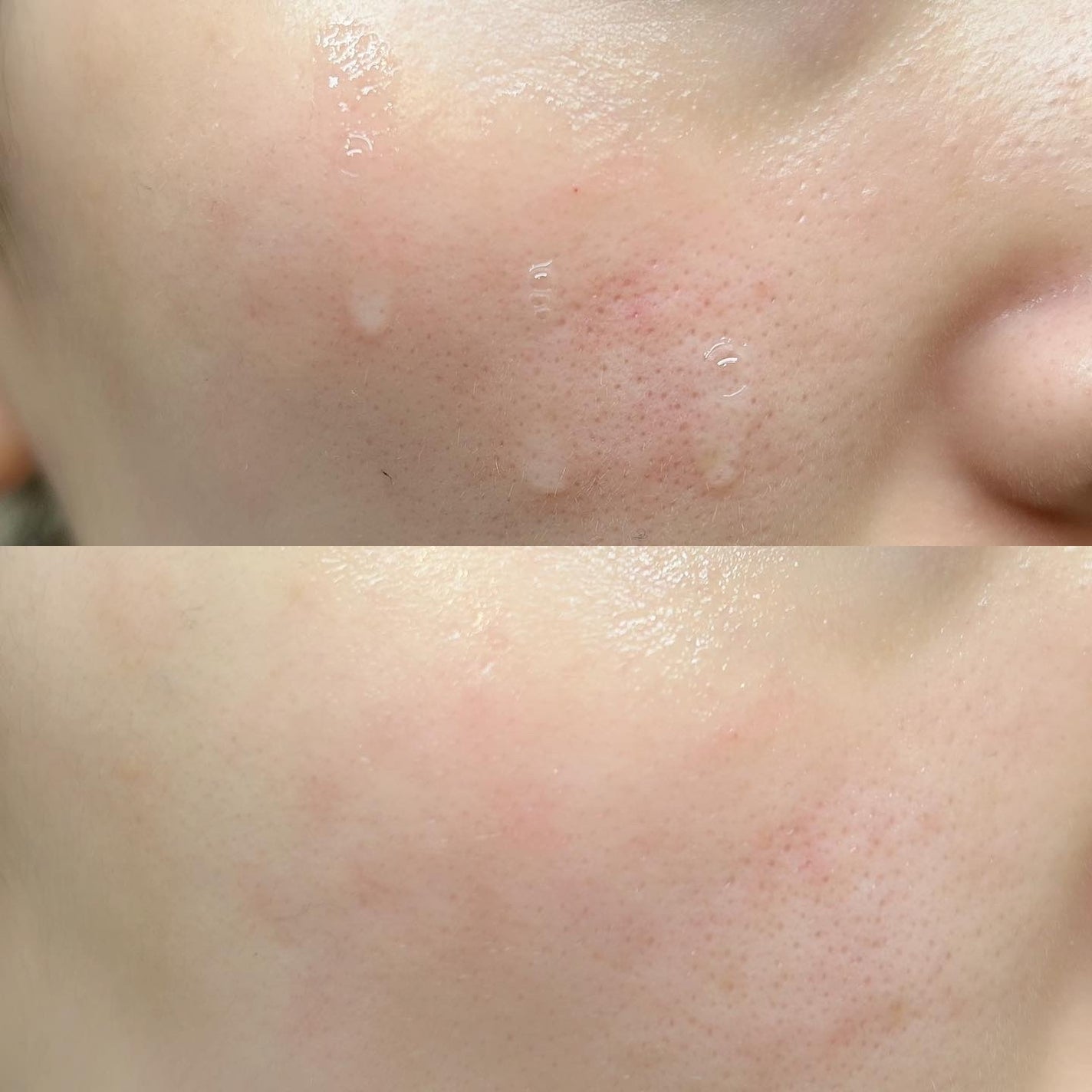 ルミエール ヴァイタルC/FEMMUE/ブースター・導入液を使ったクチコミ(3枚目)