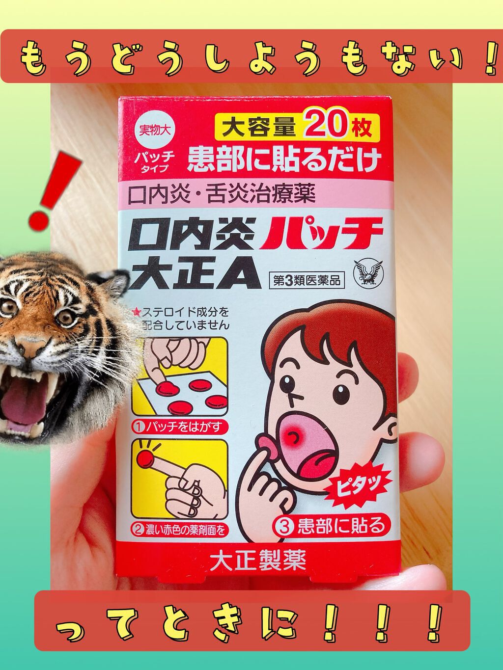 口内炎パッチ大正A(医薬品)/大正製薬/その他を使ったクチコミ(1枚目)