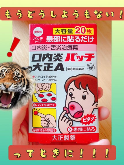 口内炎パッチ大正A(医薬品)/大正製薬/その他を使ったクチコミ(1枚目)
