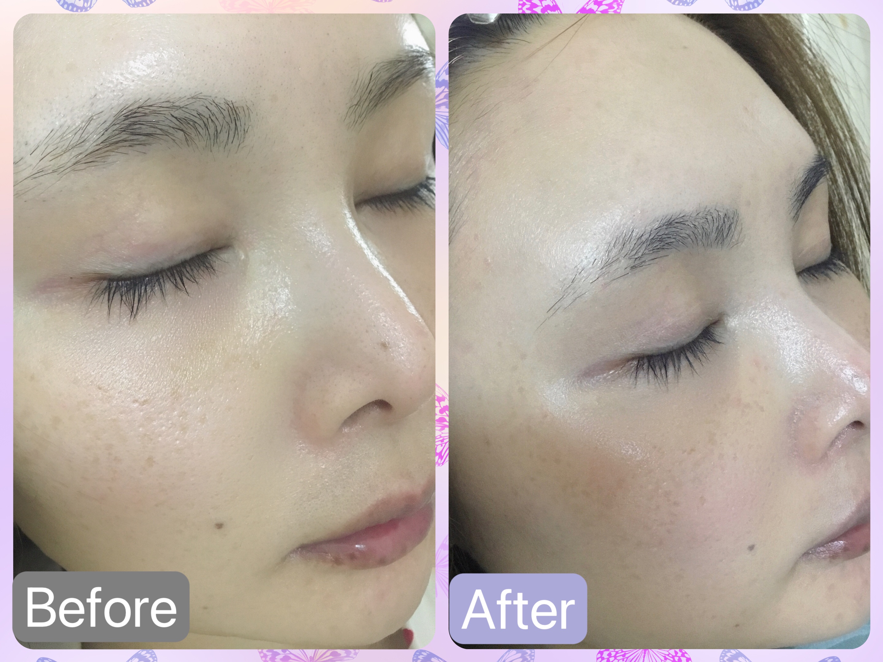 プロバイオダーム™ コラーゲン トーンアップサンクリーム/BIOHEAL BOH/日焼け止めクリームを使ったクチコミ（3枚目）