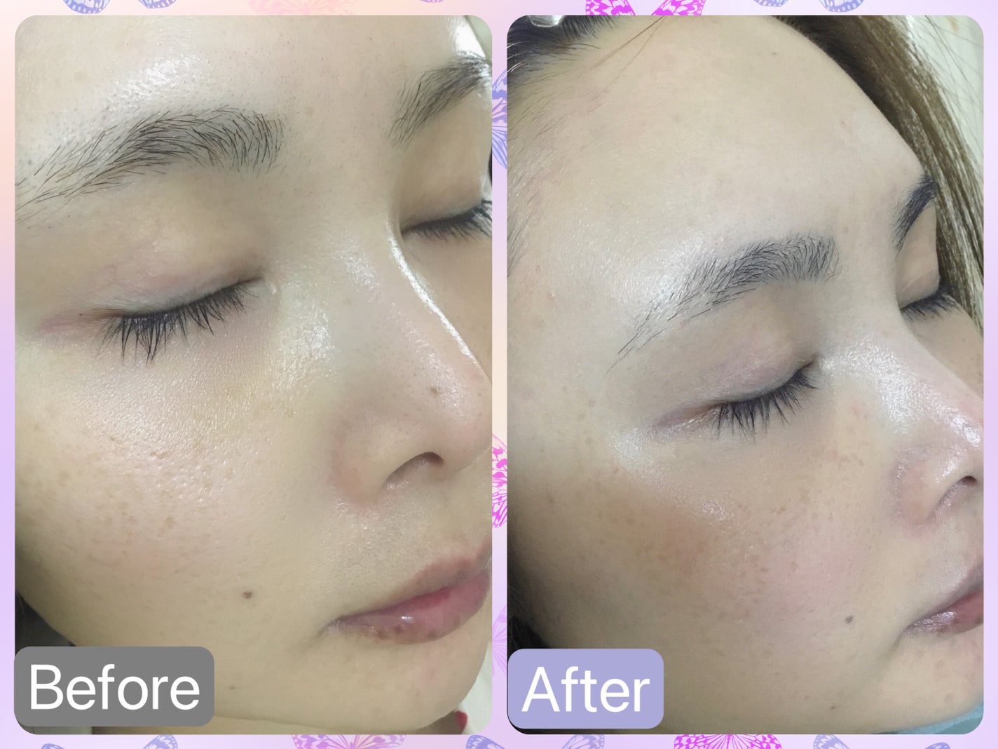 プロバイオダーム™ コラーゲン トーンアップサンクリーム/BIOHEAL BOH/日焼け止めクリームを使ったクチコミ(3枚目)