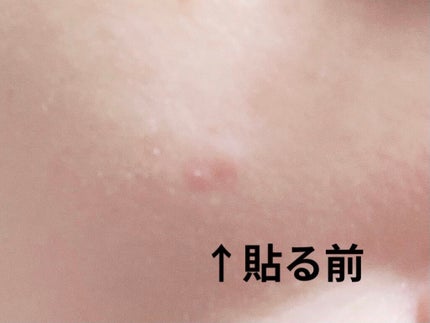 あげぱん on LIPS 「こんばんは!OKクリアパッチ<コンシーラーパッチ>を使用させて..」(6枚目)