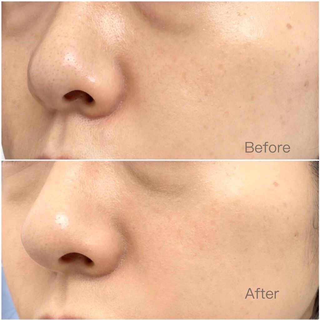 フィットミー リキッドファンデーション R/MAYBELLINE NEW YORK/リキッドファンデーションを使ったクチコミ(7枚目)