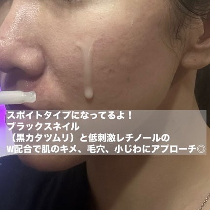 ブラックスネイル クリーム/Dr.G/フェイスクリームを使ったクチコミ(5枚目)