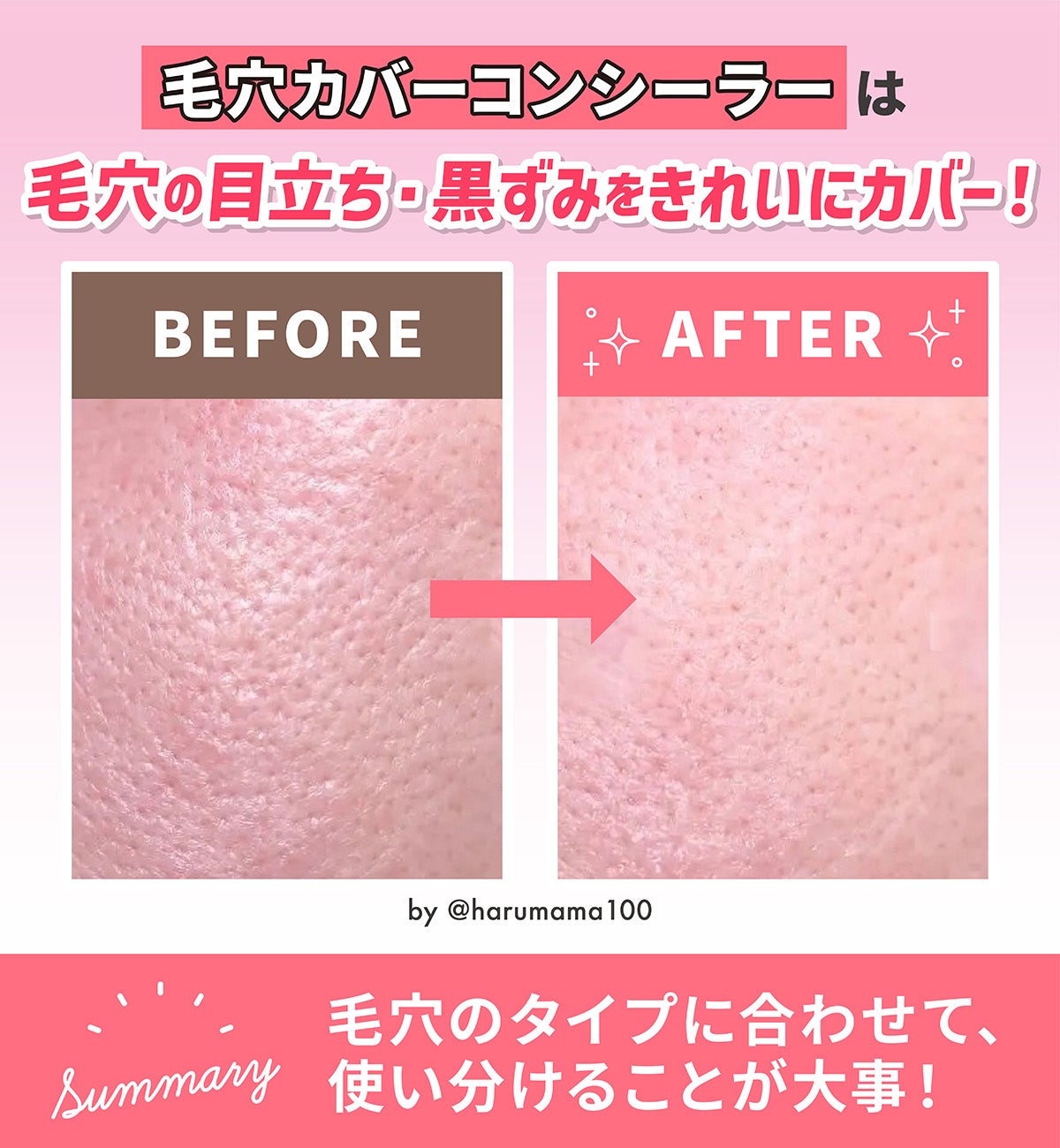 毛穴カバーコンシーラーは毛穴の目立ち・黒ずみをきれいにカバー!毛穴のタイプに合わせて、使い分けることが大事!