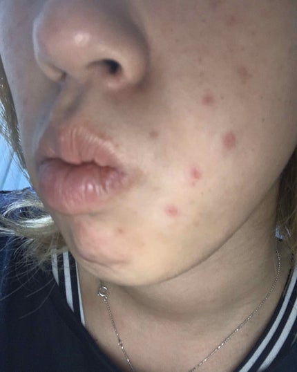 インビジブルピーリングブースターエッセンス/CNP Laboratory/ブースター・導入液を使ったクチコミ(3枚目)