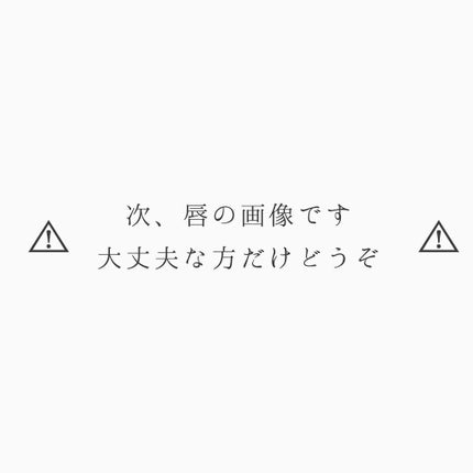 フィクシングティント/ETUDE/リップティントを使ったクチコミ(2枚目)