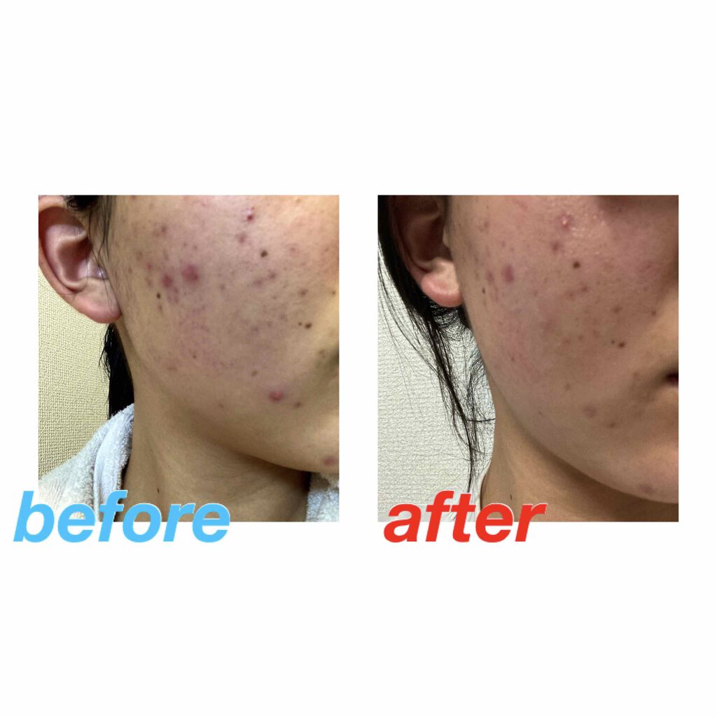 7 day Special Set プログラム3/b.glen/トライアルキットを使ったクチコミ(3枚目)