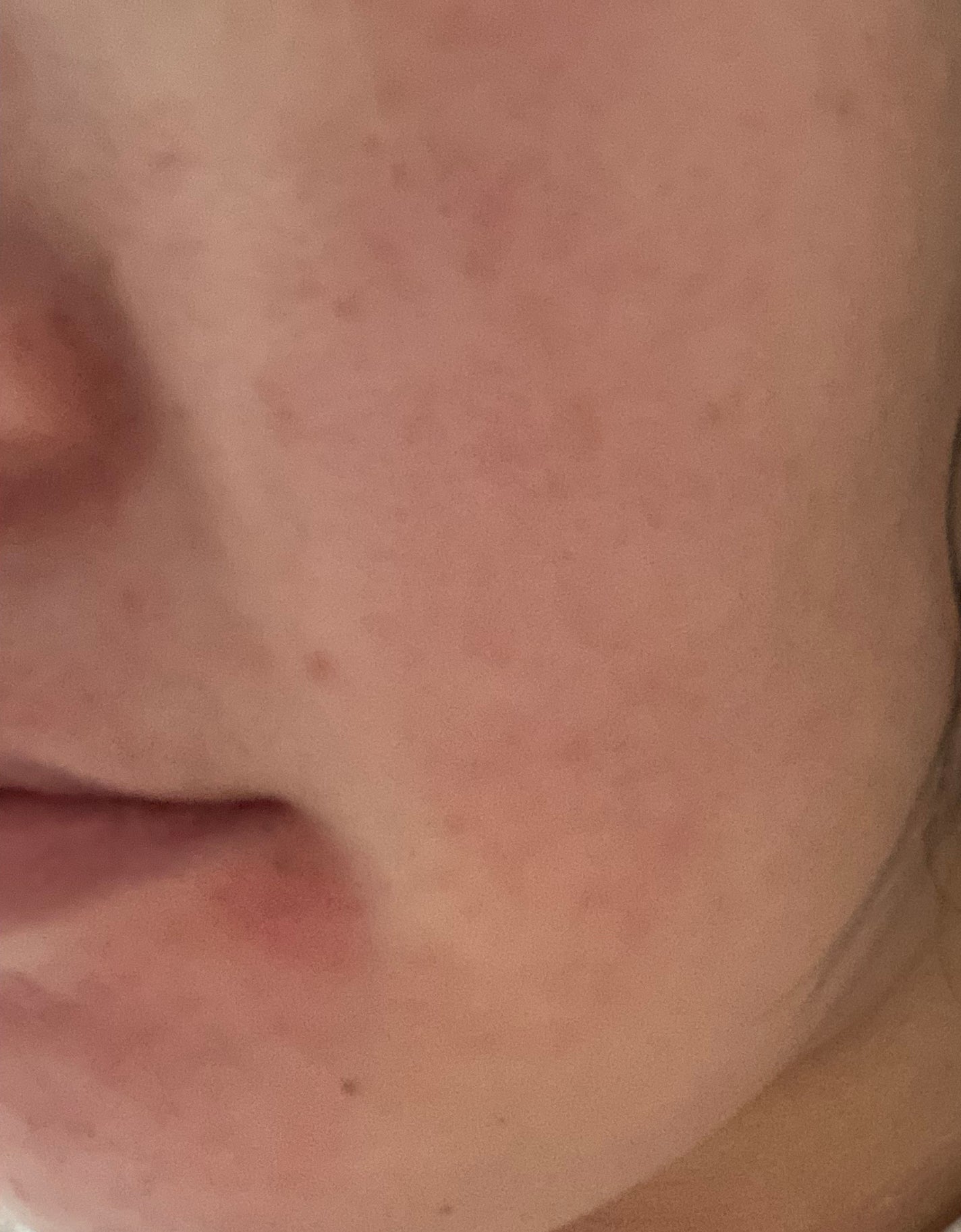 豆腐メンタルこむぎ on LIPS 「#混合肌_スキンケア#肌ケア気合い入れ直し記録✍️..」(3枚目)