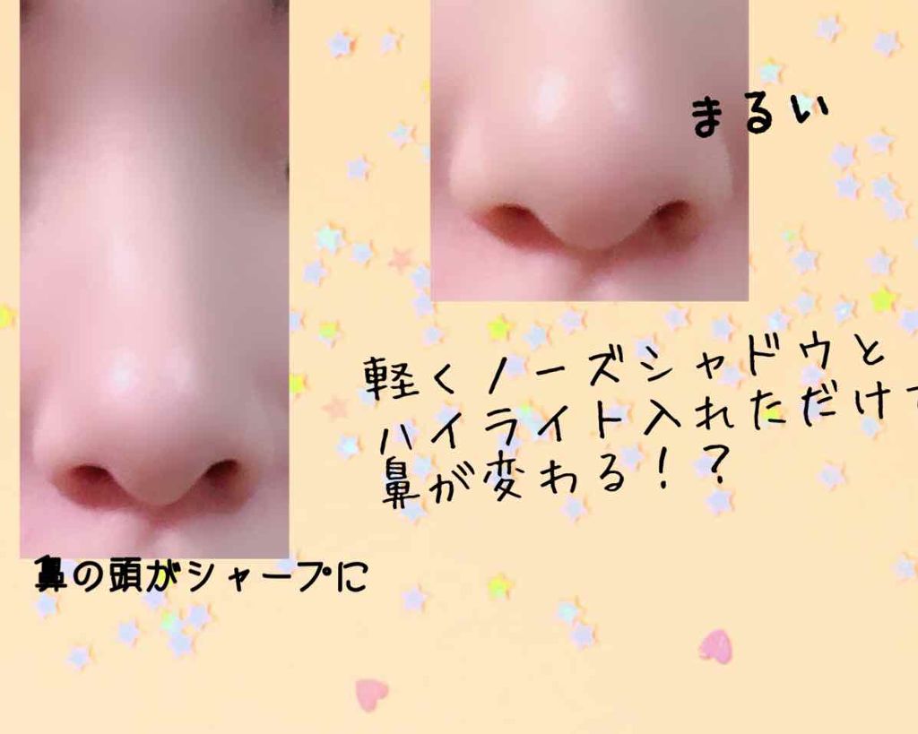 鼻の頭