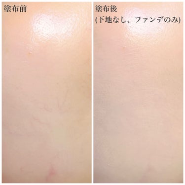 エッセンス スキングロウ ファンデーション 230 Alder/SHISEIDO/リキッドファンデーションを使ったクチコミ（2枚目）