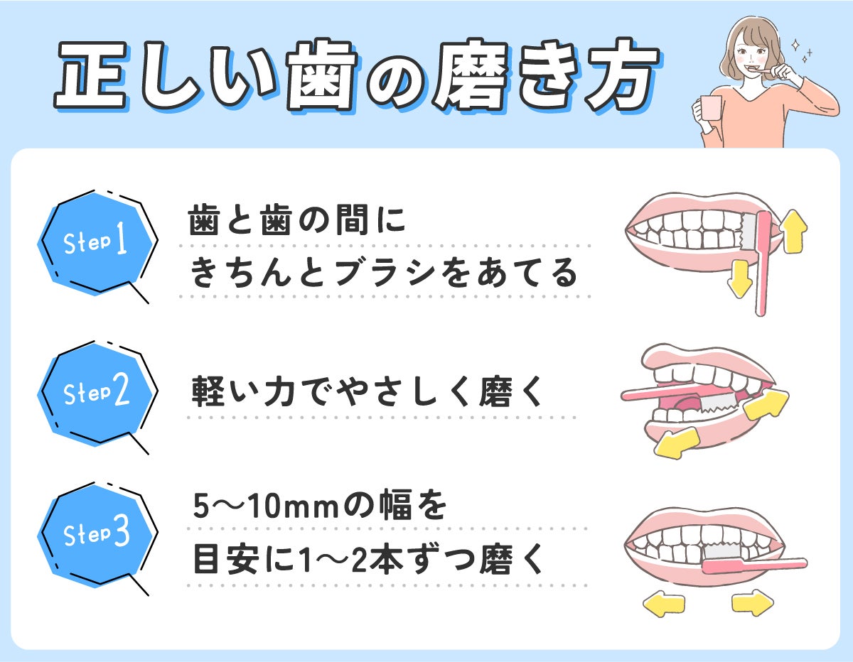 正しい歯の磨き方。歯と歯の間にきちんとブラシをあてて軽い力でやさしく磨く。5~10mmの幅を目安に1~2本ずつ磨く。