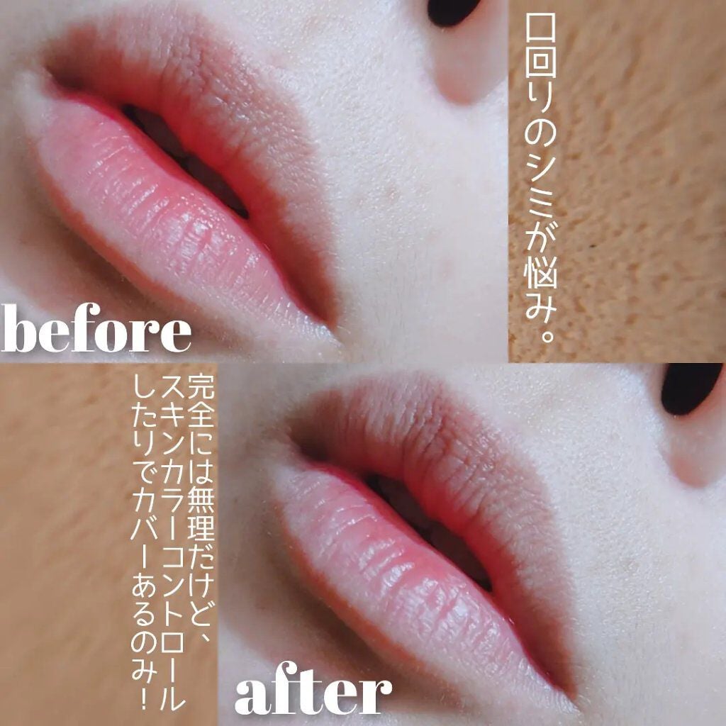 ðððð â¡â» on LIPS ãplusRESTOREãã©ã¹ãªã¹ãã¢DTã«ã¢ãã©ãŒãžã¥ã³ã³ã·ãŒ..ãïŒ8æç®ïŒ