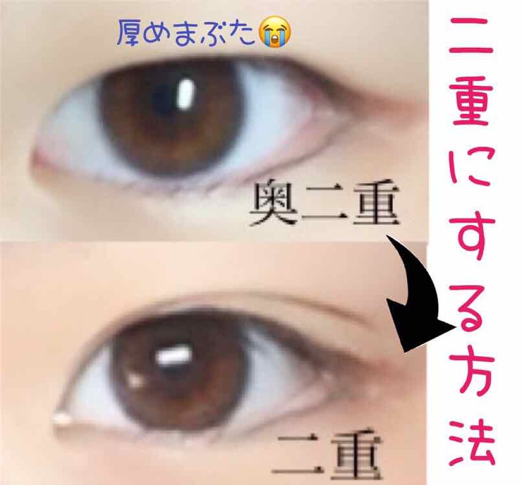理想のふたえ ぱっちり幅広 ヌーディーワイド セリアの口コミ 超優秀 100均で買えるおすすめ二重まぶた用アイテム こんばんは ﻌ By ー 乾燥肌 Lips
