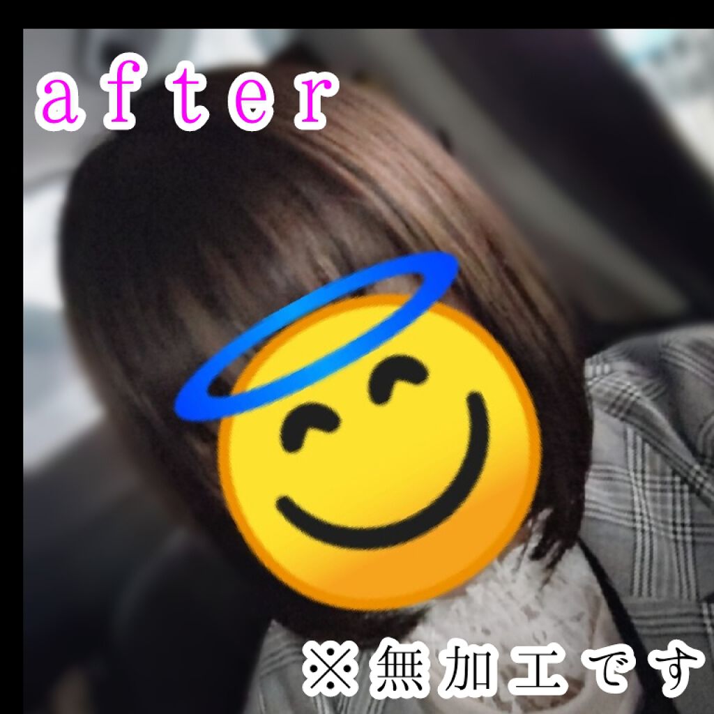 オキシドール(医薬品)/日本薬局方/その他を使ったクチコミ(3枚目)
