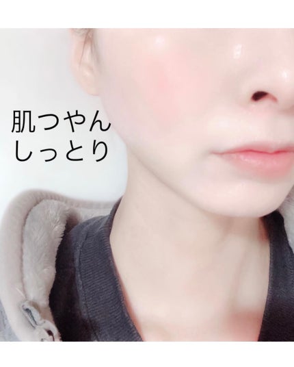 ダイブイン セラム/Torriden/美容液を使ったクチコミ(5枚目)