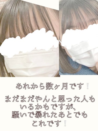 𝑠𝑎𝑛𝑎 on LIPS 「こんにちは❕さなです♡今回は垢抜け方法を紹介します❕※前回の投..」（5枚目）