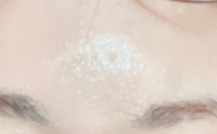 ゆぽぽㄘゃん(フォロバ100) on LIPS 「\悩みのシワに貼って寝るだけ!/「ナールズインパクトリペア」(..」(4枚目)