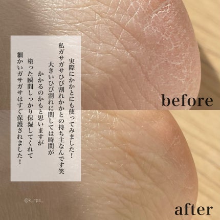 MECHAI シカサルブクリーム/MECHAI/ボディクリームを使ったクチコミ(7枚目)