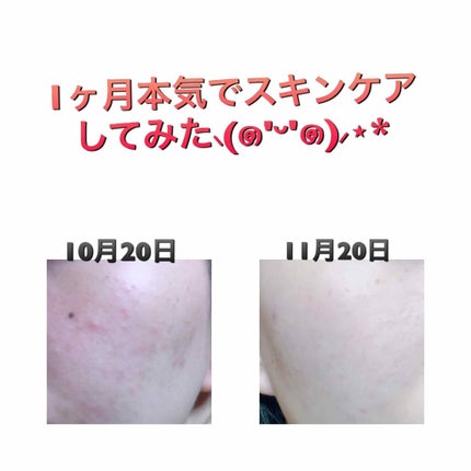 いつかの石けん/水橋保寿堂製薬/洗顔石鹸を使ったクチコミ(1枚目)