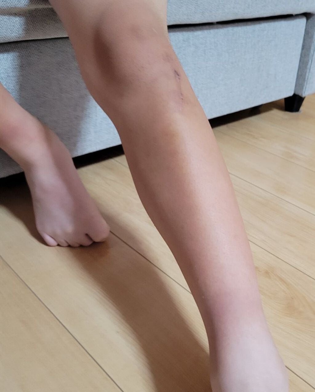 薬用Zリムーバー/コスメ二スト/除毛クリームを使ったクチコミ(4枚目)