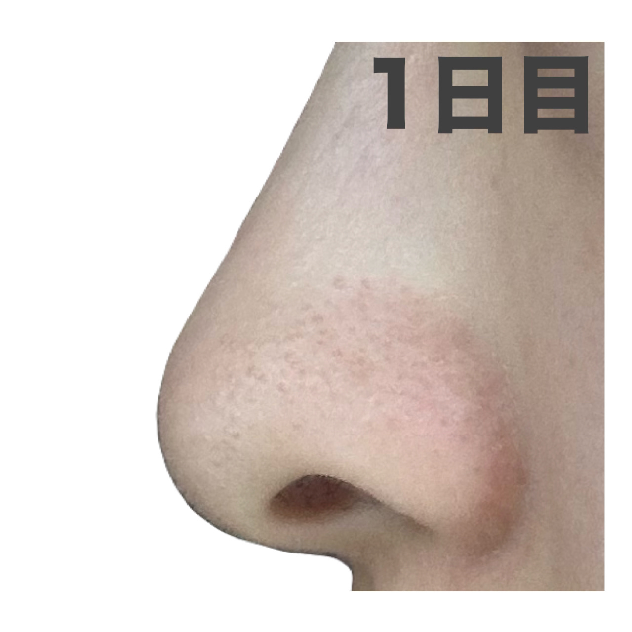 デュオ ザ ウォッシュ ブラックリペア/DUO/洗顔パウダーを使ったクチコミ（3枚目）