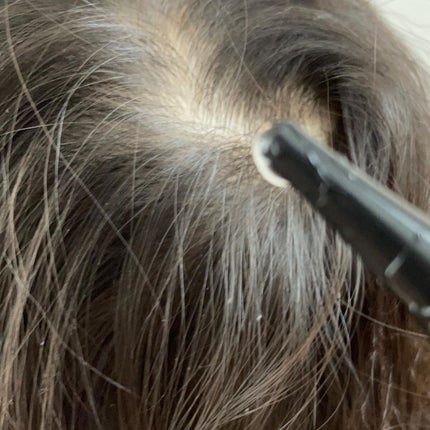 ナノグロウリッチ/iqumore/頭皮ローションを使ったクチコミ(5枚目)