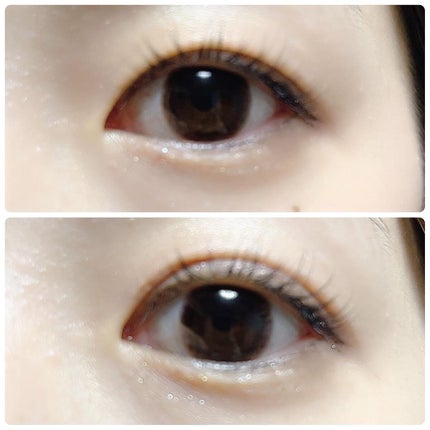 湘南美容アイリッドグルー/湘南美容/二重まぶた用アイテムを使ったクチコミ(4枚目)