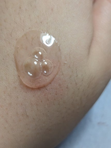 桃70%ナイアシンセラム/Anua/美容液を使ったクチコミ(5枚目)