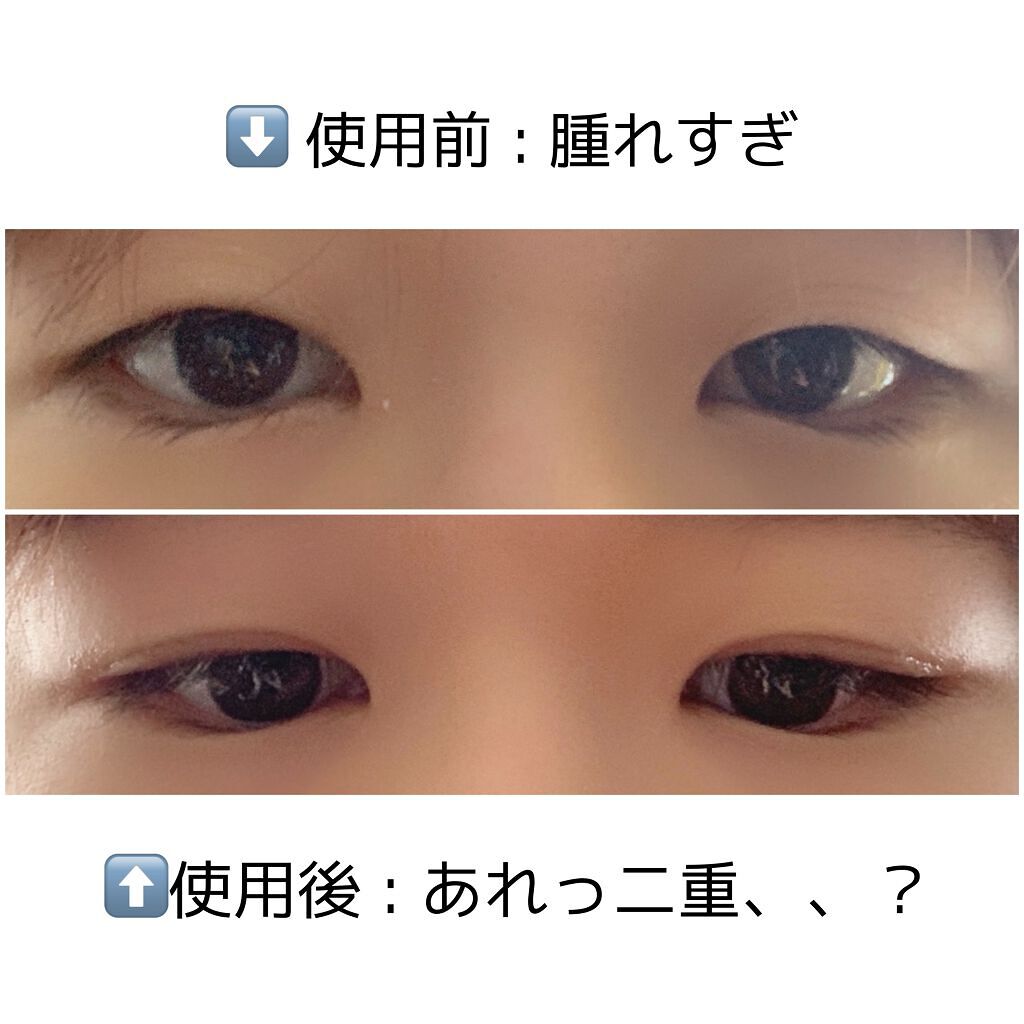 K-パレット　フタエラボ　リアルダブルアイリッドグルー/K-パレット/二重まぶた用アイテムを使ったクチコミ（1枚目）