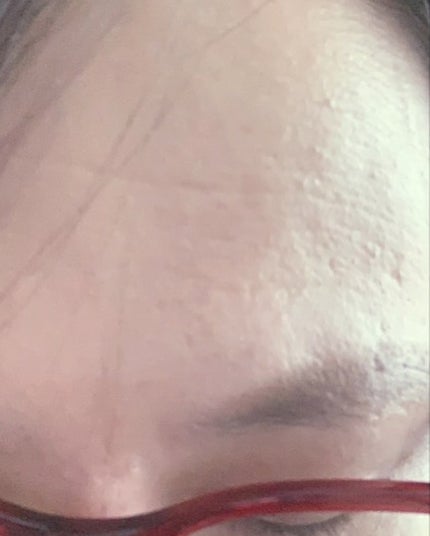 ダーマセプトRX AZAセラム/ダーマセプトRX/美容液を使ったクチコミ(3枚目)