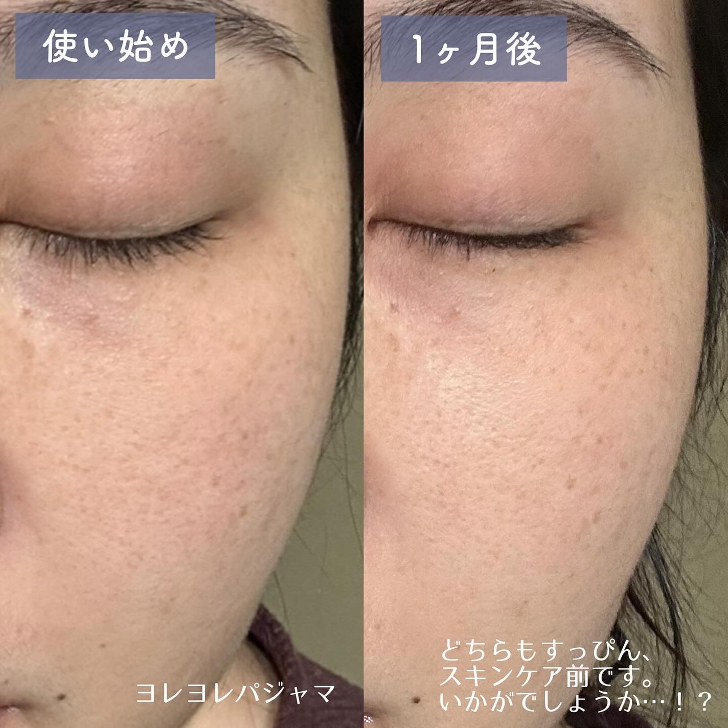 ギミヤホワイトニングクリーム/TONYMOLY/フェイスクリームを使ったクチコミ(5枚目)