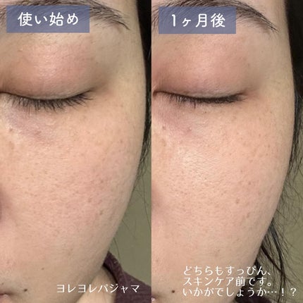 ギミヤホワイトニングクリーム/TONYMOLY/フェイスクリームを使ったクチコミ(5枚目)