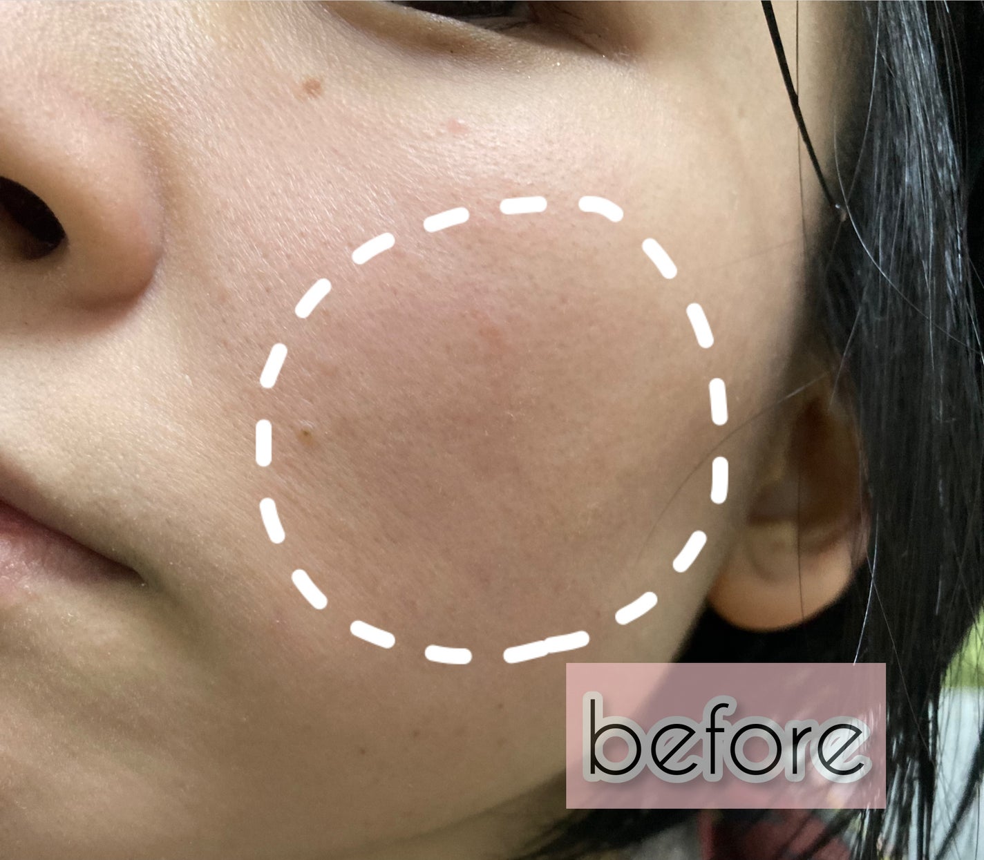 CICAトリプルリペアマスク /我的美麗日記/シートマスク・パックを使ったクチコミ(3枚目)