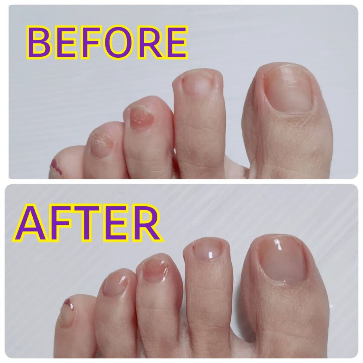 グロスフォーユアネイル/プレビュート/オールインワンネイルを使ったクチコミ（3枚目）